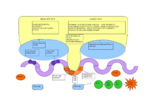 Leaky Gut Dysbios Cancer