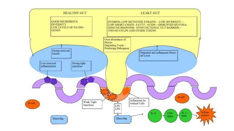 Leaky Gut Dysbios Cancer